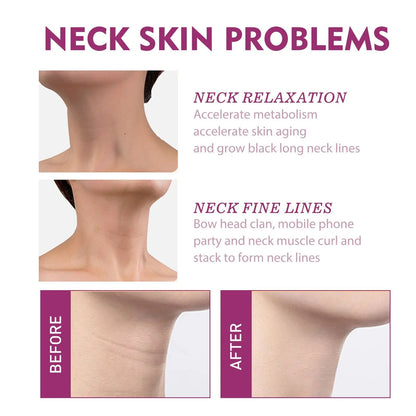 🔥Last Day 50% OFF - 🌿🧴Alcuras® Hydrolyzed Collagen Neck Cream✨