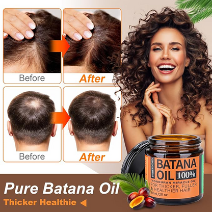 🔥LAST DAY 49% OFF - Batana Oil for Hair Growth,Raw Organic Batana Mask from Honduras🌱