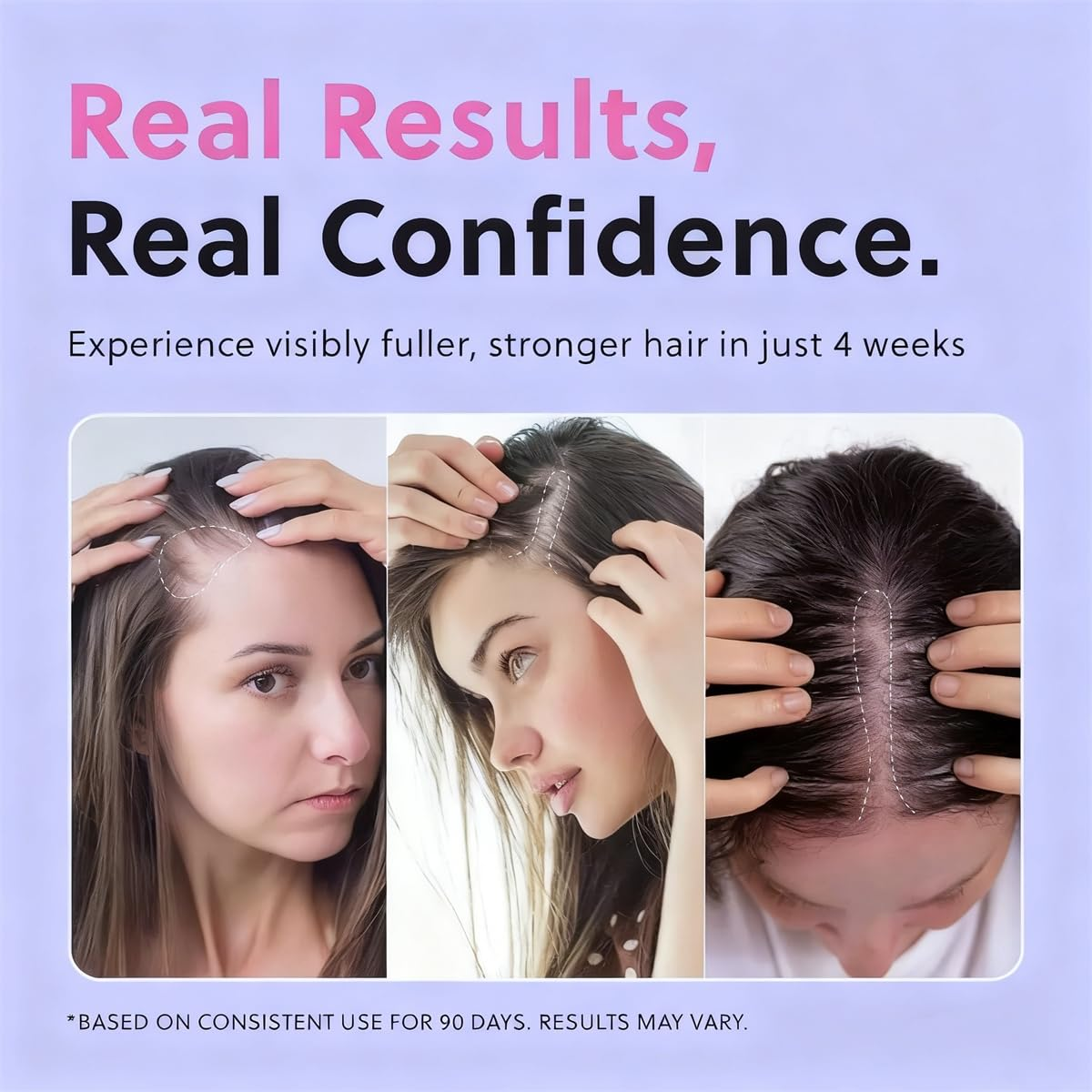 🎉Buy One Get One Free🎁 - ✨ Alcuras® Biotin Hair Growth Spray🧴💆