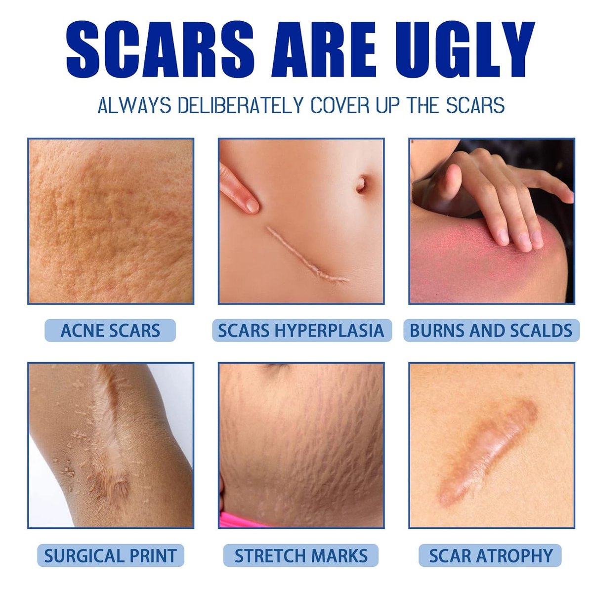 🔥Last Day 50% OFF - 🩹Alcuras® Advanced Scar Repair Cream✨