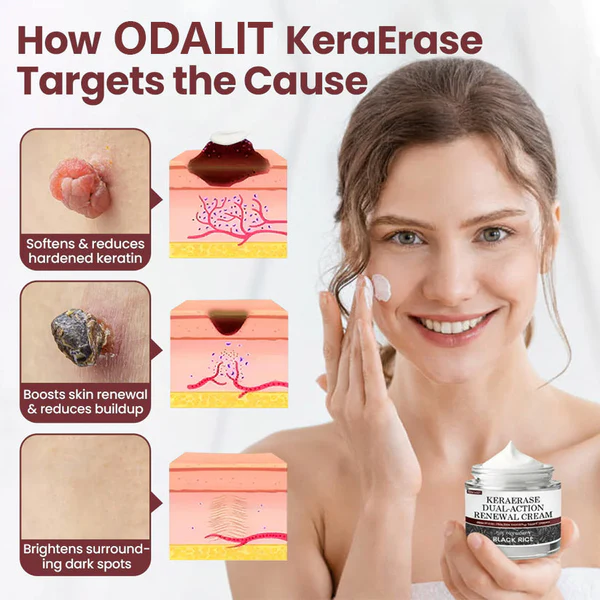 🔥Last Day 49% OFF - 🎉Flash Sale - Alcuras® Dual-Action Renewal Cream🩹✨