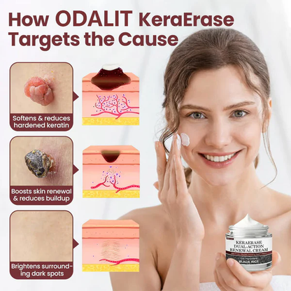 🔥Last Day 49% OFF - 🎉Flash Sale - Alcuras® Dual-Action Renewal Cream🩹✨