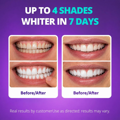 🔥Last Day 49% OFF - 🦷Purple Teeth Whitening Strips, Enamel-Safe Stain Removal💜