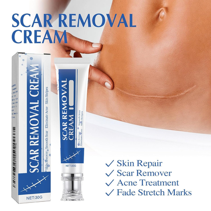 🩹 Alcuras® Medical Grade Silicone Scar Cream – Smooth Scars Fast!
