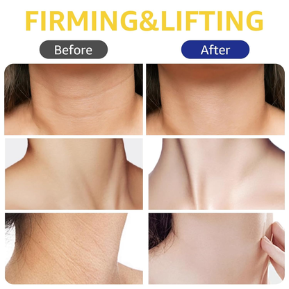🎉Buy One Get One Free🎁 - 🧴Alcuras Firming & Lifting Neck Cream✨