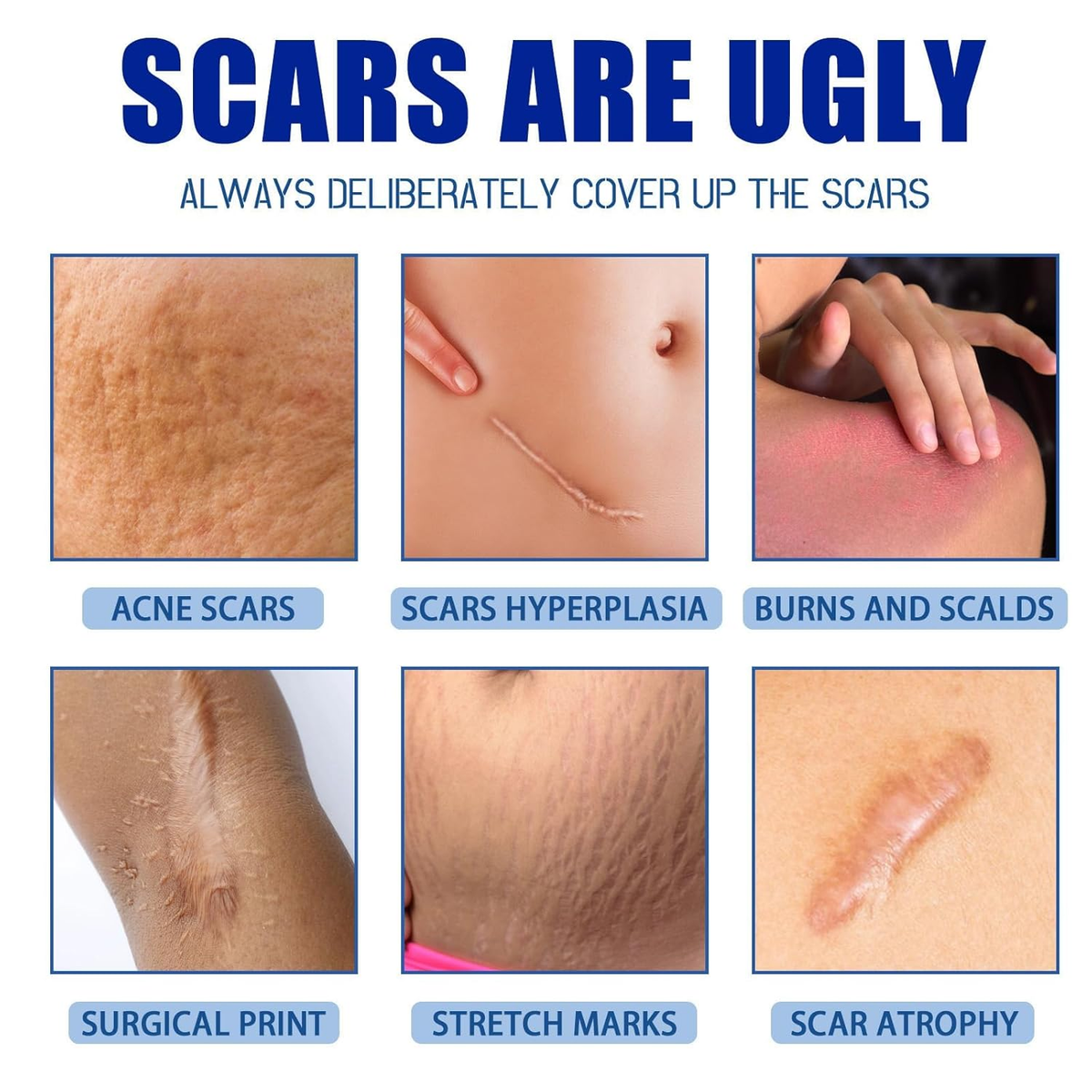 🩹 Alcuras® Medical Grade Silicone Scar Cream – Smooth Scars Fast!